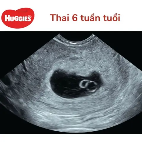 Cách Chăm Sóc Thai Nhi 5 Tuần Tuổi Cách Chăm Sóc Thai Nhi 5 Tuần Tuổi