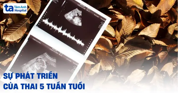 Cách Chăm Sóc Thai Nhi 5 Tuần Tuổi