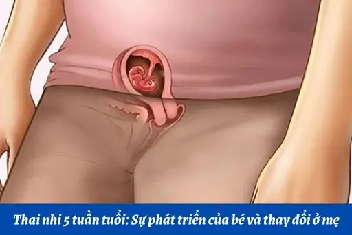 Cách Chăm Sóc Thai Nhi 5 Tuần Tuổi Cách Chăm Sóc Thai Nhi 5 Tuần Tuổi
