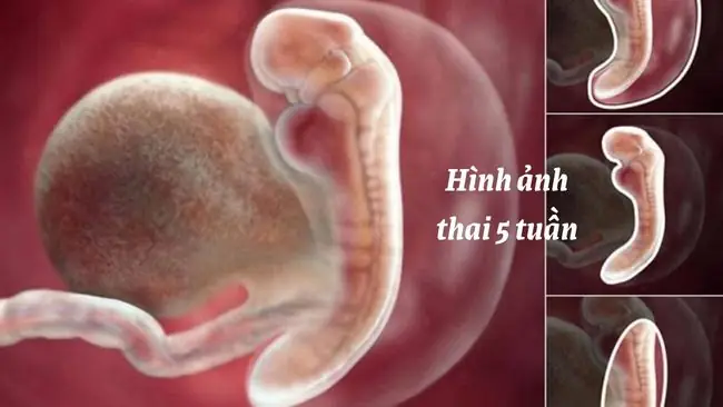 Cách Chăm Sóc Thai Nhi 5 Tuần Tuổi Cách Chăm Sóc Thai Nhi 5 Tuần Tuổi