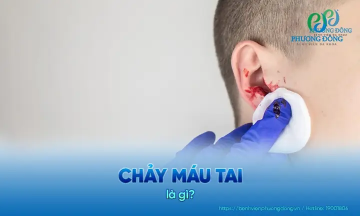 Cách Chữa Bị Rỗng Tia Sữa