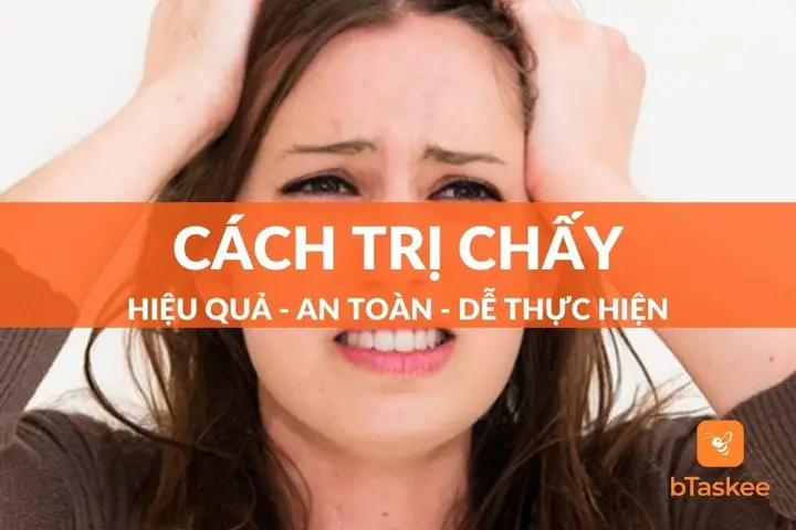 Cách Chữa Chấy Hiệu Quả Nhất Cách Chữa Chấy Hiệu Quả Nhất