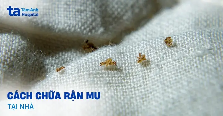 Cách Chữa Chấy Hiệu Quả Nhất
