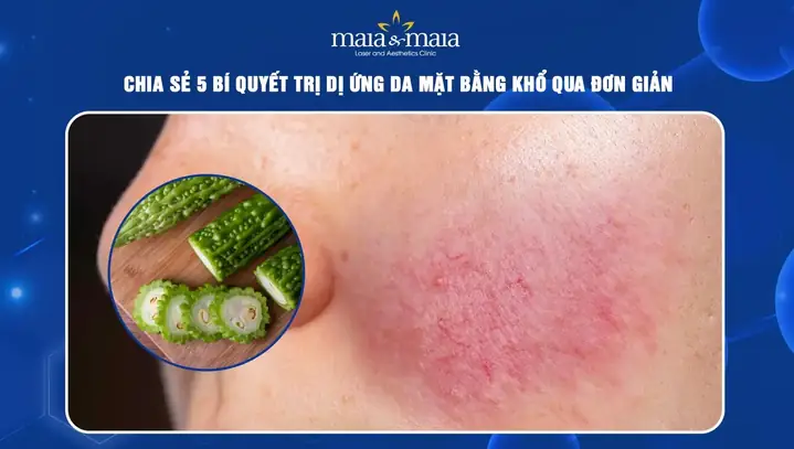 Cách Chữa Dị Ứng Da Mặt Bằng Mướp Đắng