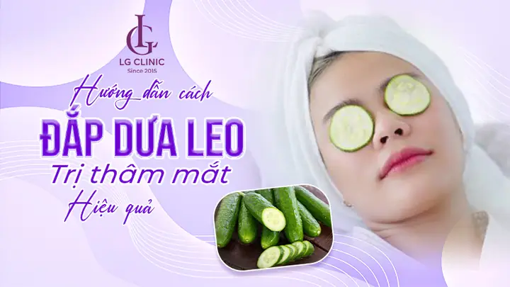 Cách Đắp Dưa Leo Trị Mụn