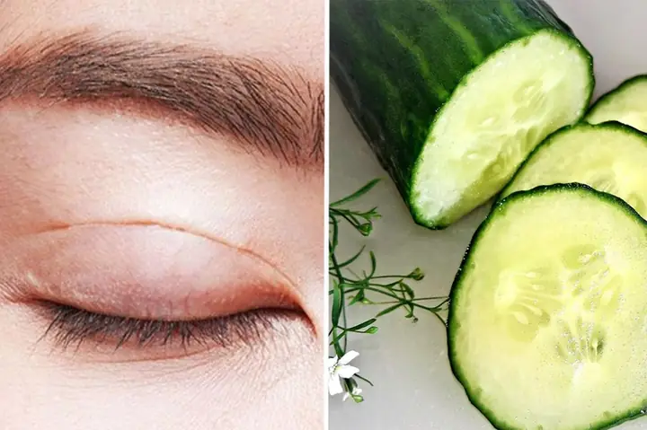 Cách Đắp Dưa Leo Trị Mụn
