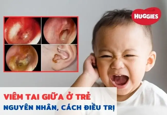 Cách Điều Trị Bệnh Ho Ở Trẻ Em