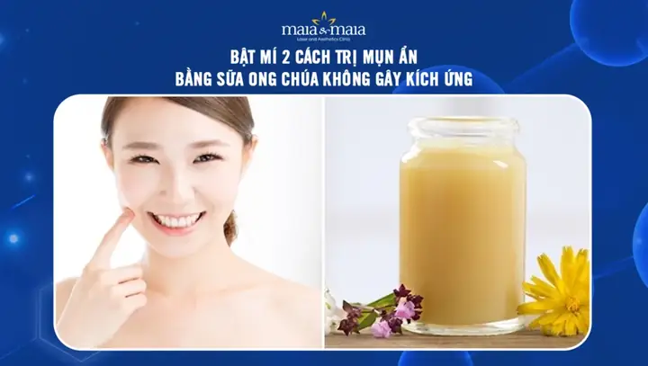 Cách Dưỡng Da Bằng Sữa Ong Chúa