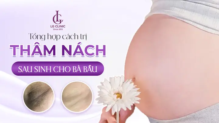 Cách Hơ Nách Sau Khi Sinh