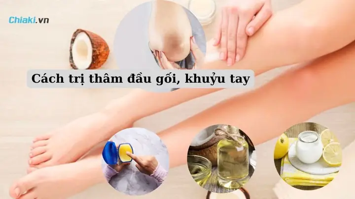 Cách Làm Bớt Thâm Đầu Gối
