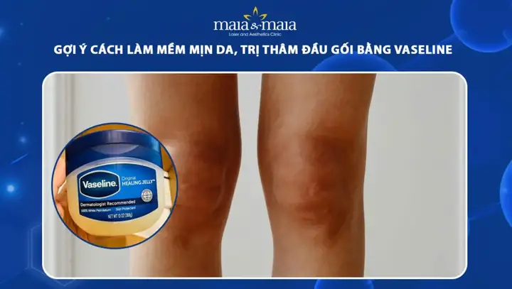 Cách Làm Bớt Thâm Đầu Gối