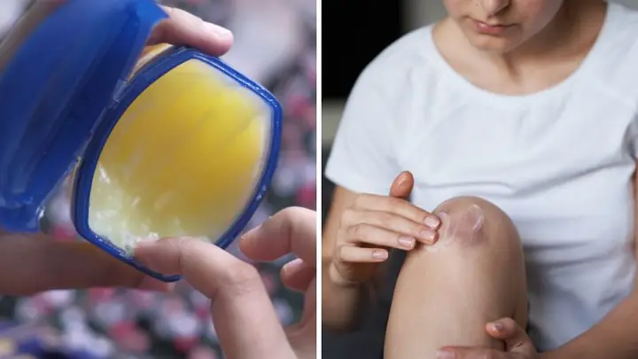 Cách Làm Bớt Thâm Đầu Gối
