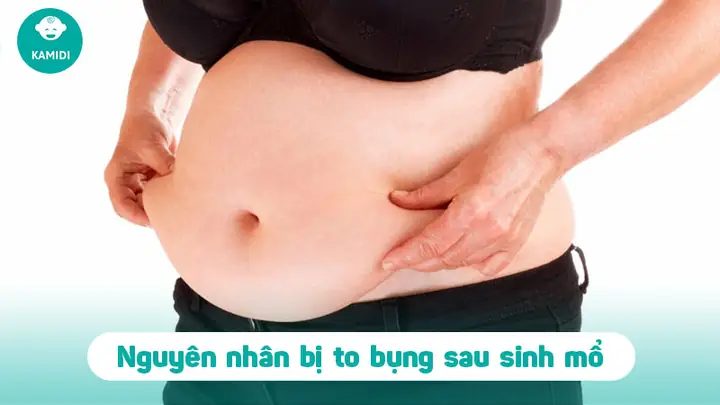 Cách Làm Bụng Nhỏ Lại Sau Sinh Mổ