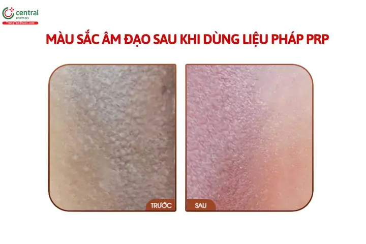 Cách Làm Cho Cô Bé Hồng Hào Se Khít Cách Làm Cho Cô Bé Hồng Hào Se Khít