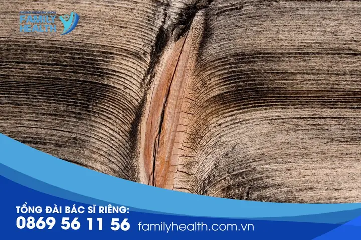 Cách Làm Cho Vùng Kín Hết Thâm