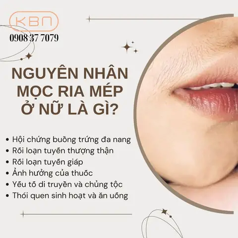 Cách Làm Giảm Ria Mép Ở Con Gái Cách Làm Giảm Ria Mép Ở Con Gái