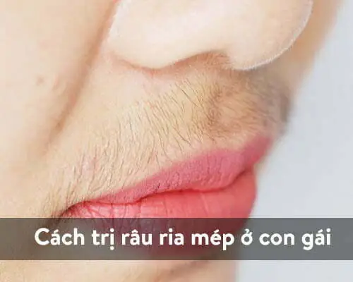 Cách Làm Giảm Ria Mép Ở Con Gái Cách Làm Giảm Ria Mép Ở Con Gái