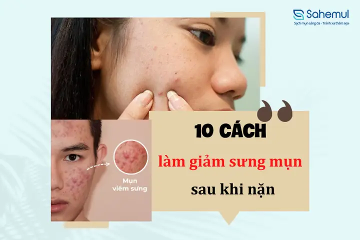 Cách Làm Giảm Thâm Sau Khi Nặn Mụn
