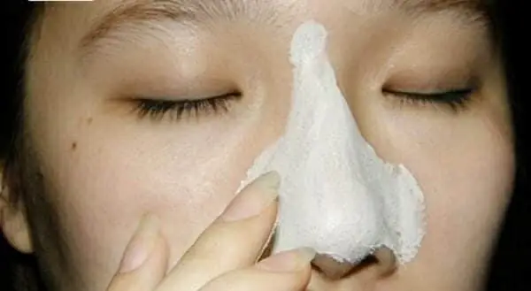 Cách Làm Mặt Nạ Lột Mụn Bằng Keo Sữa