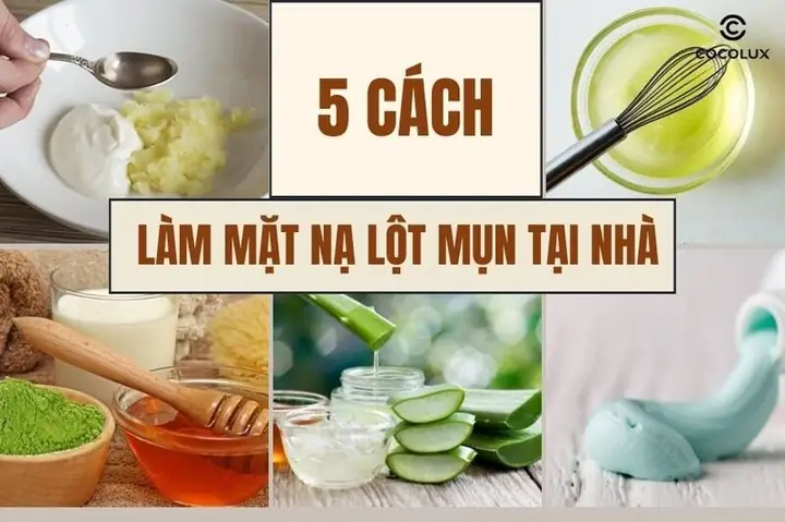 Cách Làm Mặt Nạ Lột Mụn Đầu Đen Tại Nhà