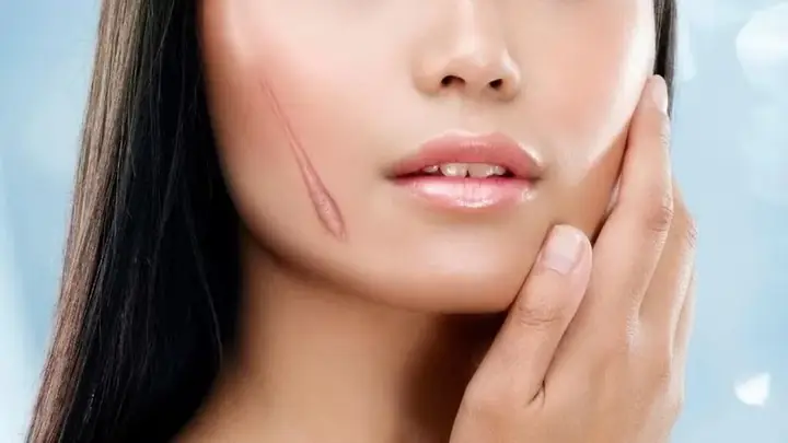 Cách Làm Mờ Sẹo Ở Mặt