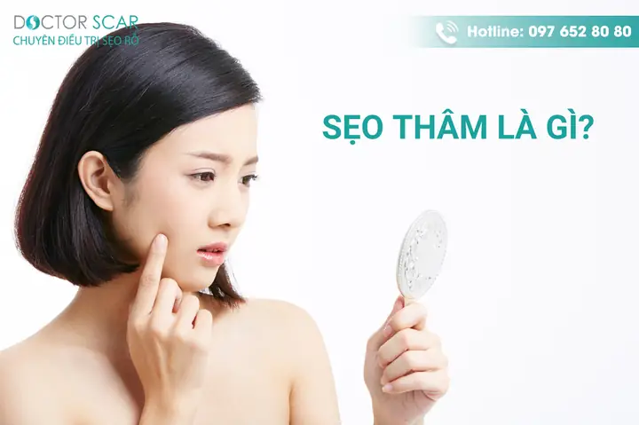 Cách Làm Mờ Sẹo Ở Mặt