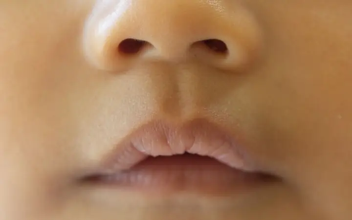 Cách Làm Môi Trẻ Sơ Sinh Hồng Hào