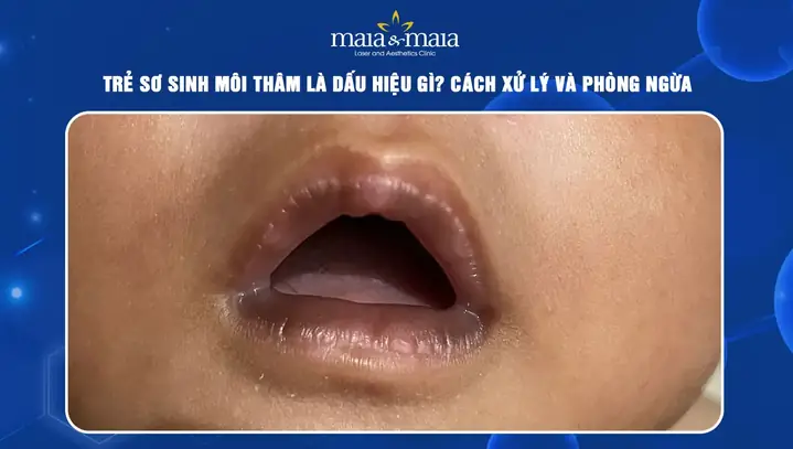 Cách Làm Môi Trẻ Sơ Sinh Hồng Hào