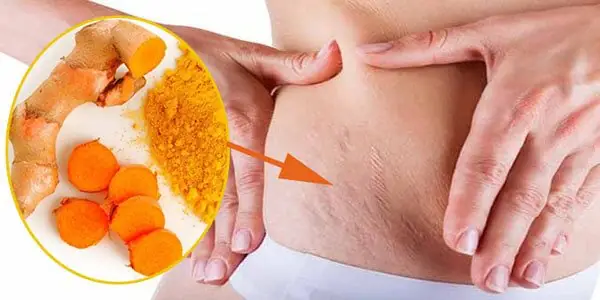 Cách Làm Rượu Nghệ Trị Rạn Da