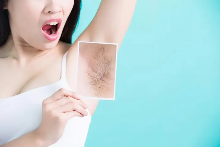Cách Làm Sạch Lông Nách Tuổi Dậy Thì