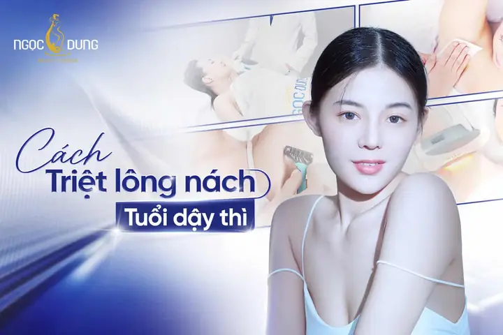 Cách Làm Sạch Lông Nách Tuổi Dậy Thì