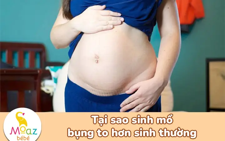 Cách Làm Săn Bụng Sau Sinh Mổ