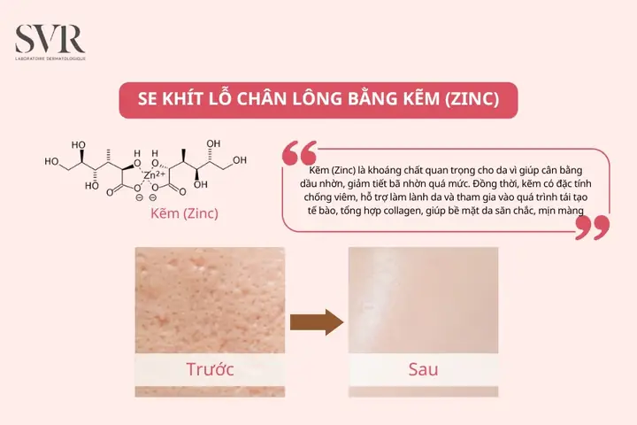 Cách Làm Se Khít Lỗ Chân Lông Bằng Sữa Tươi