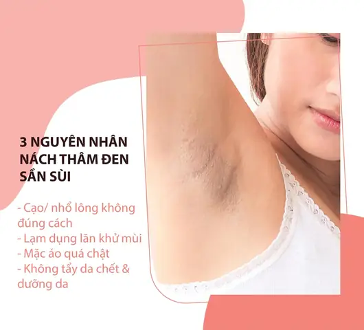 Cách Làm Se Khít Lỗ Chân Lông Ở Nách