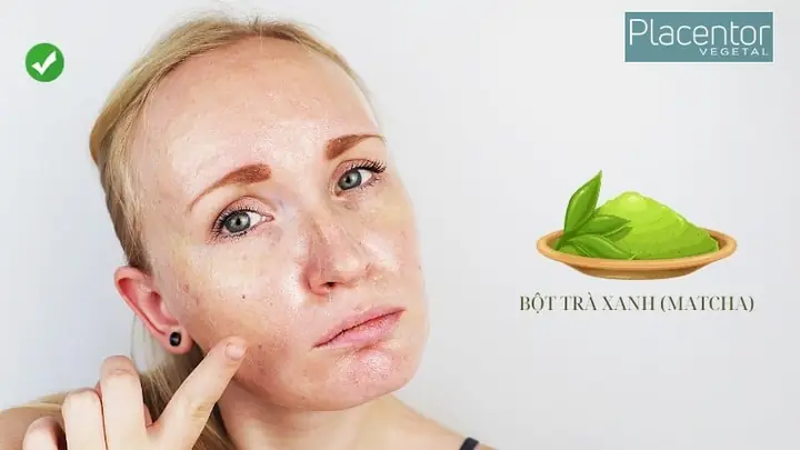 Cách Làm Sữa Rửa Mặt Từ Bột Trà Xanh Cách Làm Sữa Rửa Mặt Từ Bột Trà Xanh