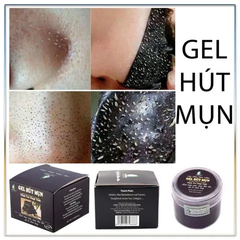 Cách Lột Mụn Bằng Than Tre