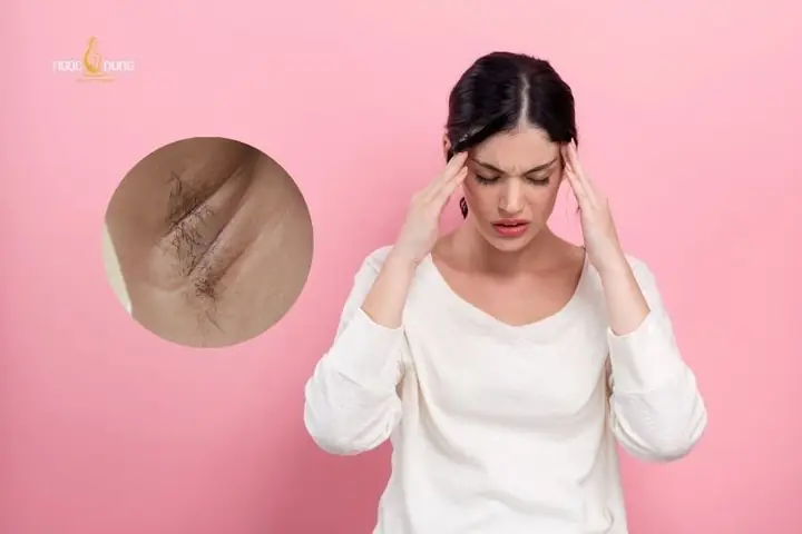 Cách Mọc Lông Nách Nam Nhanh
