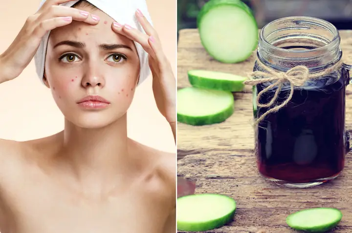 Cách Nấu Nước Bí Đao Trị Mụn