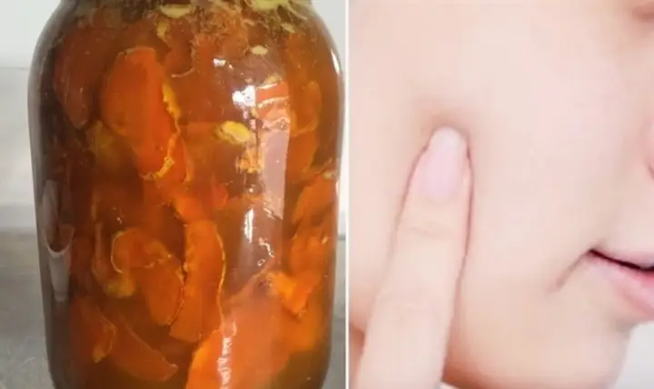 Cách Ngâm Rượu Nghệ Làm Đẹp Da