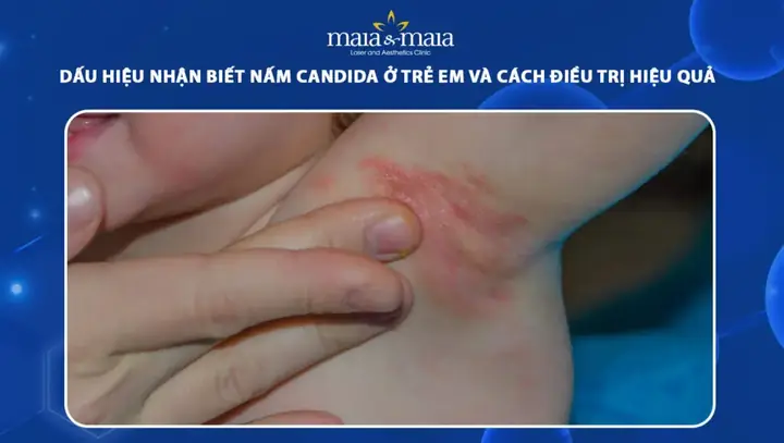 Cách Nhận Biết Mật Ong Thật 2010