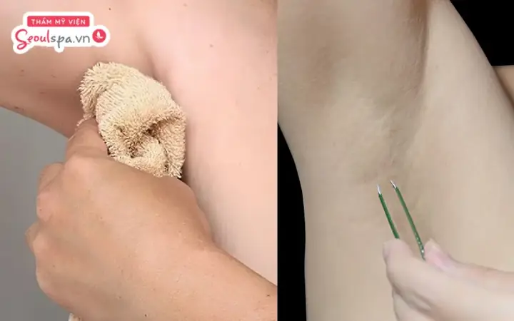 Cách Nhổ Lông Nách Không Đau Không Thâm