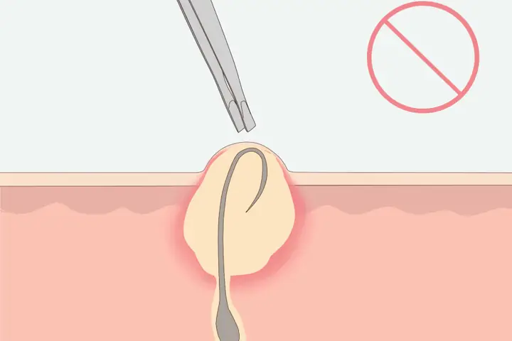 Cách Nhổ Lông Nách Không Đau Không Thâm