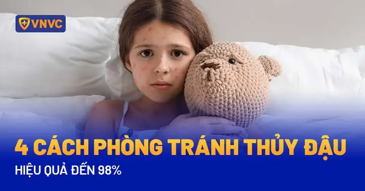 Cách Phòng Tránh Thủy Đậu Cho Bà Bầu