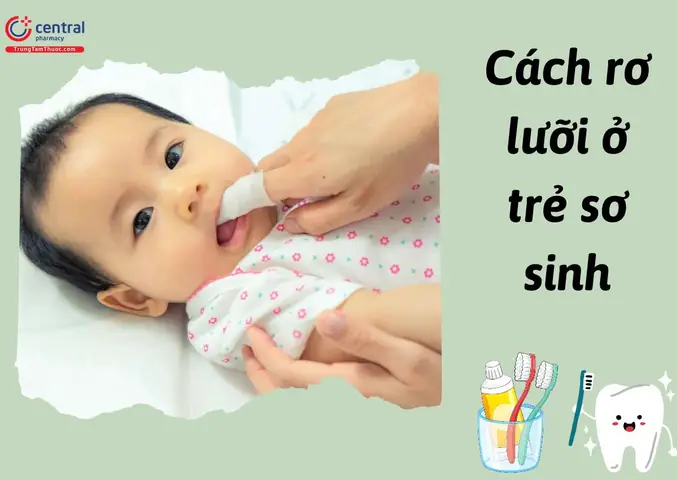 Cách Rơ Lưỡi Cho Trẻ Sơ Sinh Sạch