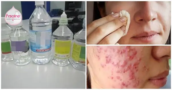 Cách Rửa Mặt Bằng Muối Sinh Lý