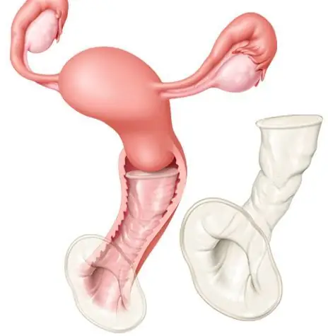 Cách Sử Dụng Bao Cao Su Nữ Giới