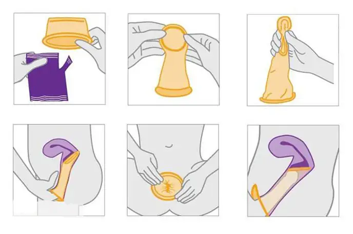 Cách Sử Dụng Bao Cao Su Nữ Giới