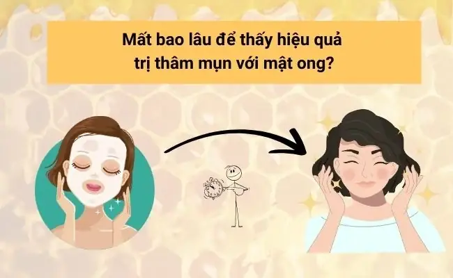 Cách Sử Dụng Mật Ong Trị Mụn