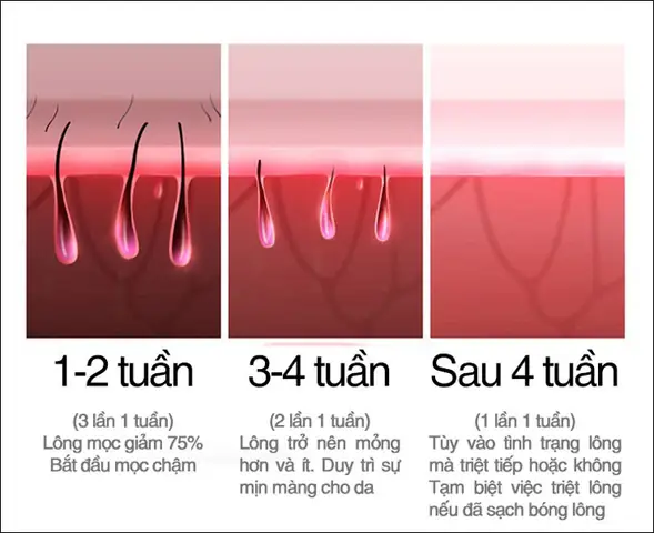 Cách Sử Dụng Máy Wax Lông Mini