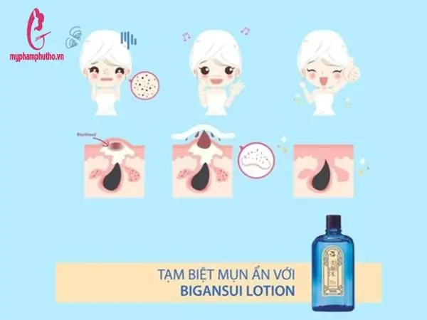Cách Sử Dụng Nước Hoa Hồng Trị Mụn Nhật Bản